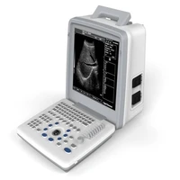 linear toshiba ultrasound machine machine for ultrasound used ultrasound machine
