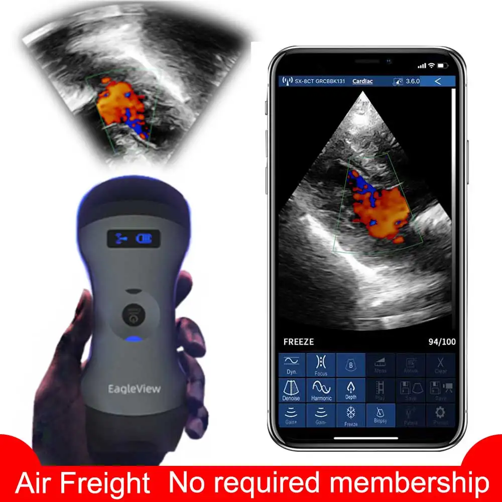 

Беспроводной ручной ультразвуковой зонд-сканер допплер, диагностика звуковых изображений тела, линейный выпуклый поэтапный Диагностическ...