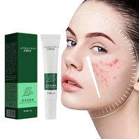 acne removal cream acne treatment fade acne spots oil control shrink pores whitening moisturizing acne cream skin care