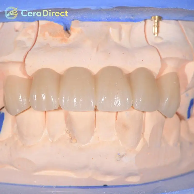 Ceradirect 3D Pro многослойная циркониевая открытая система (98 мм) для стоматологической