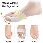 2 шт., силиконовые стельки-разделители для пальцев ног, вальгус палец ноги