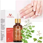 Эссенция для лечения грибка ногтей Отбеливание ногтей и ног, удаление грибка ногтей на пальцах ног, Уход за ногтями