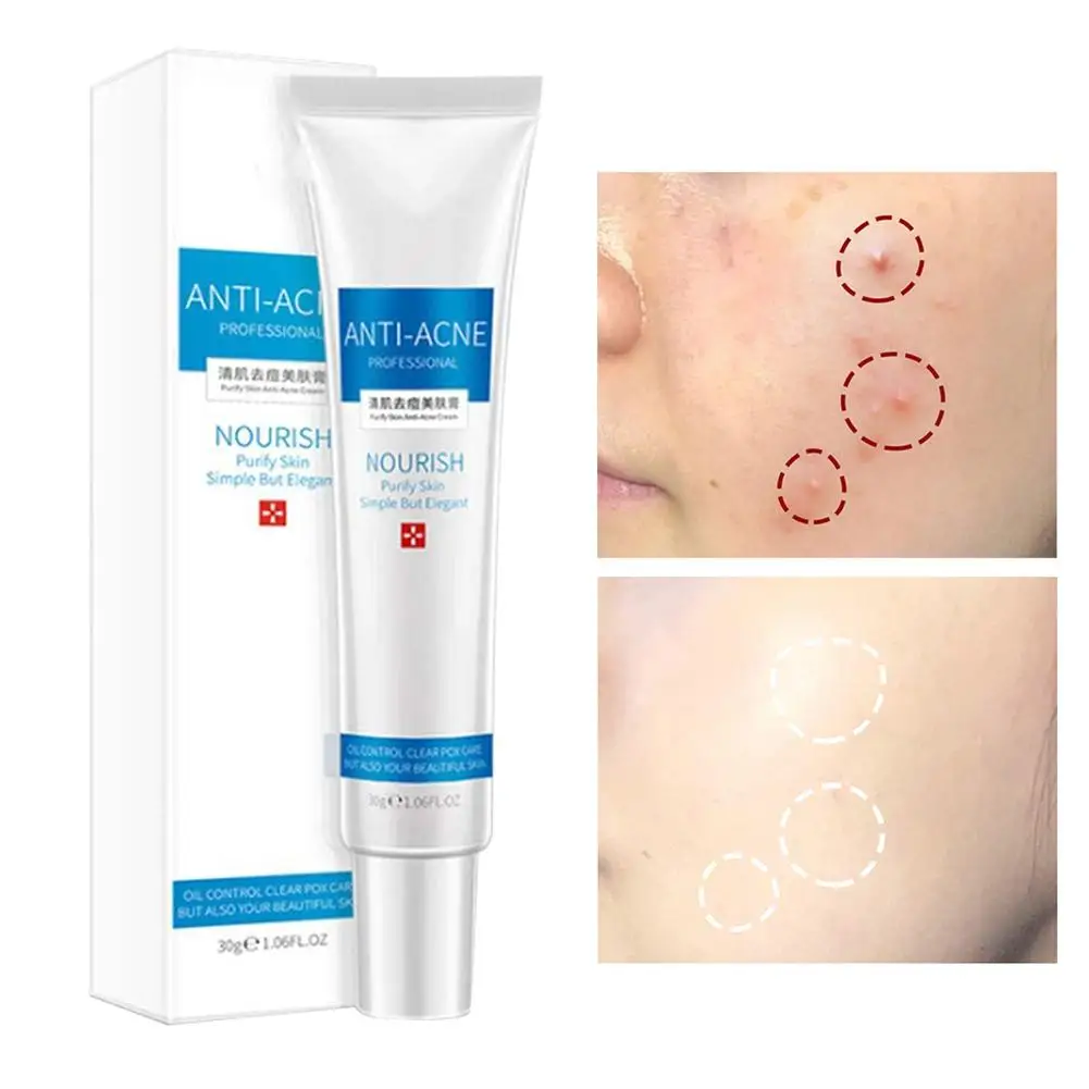 

Face Acne Treatment Blemish Cream Freckles Acne Pimple Scar Dark Spots Removal Skin Whitening Brightening Shrink Pores Skin Care