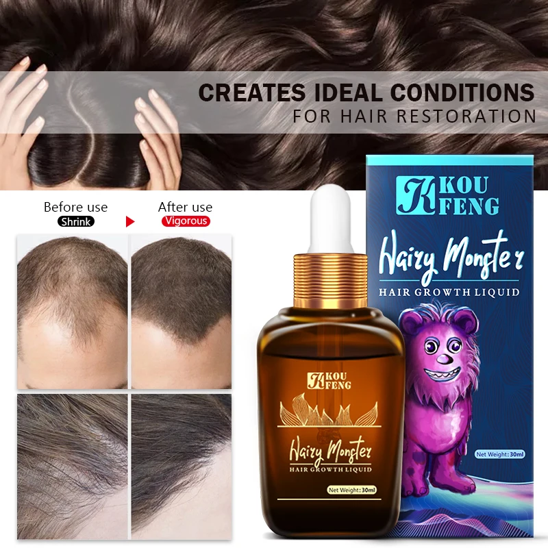 

Hair Care Hair Growth Essential Oils Hair Loss Products Natural With No Side Effects Grow Hair Faster Hair Growth Productes