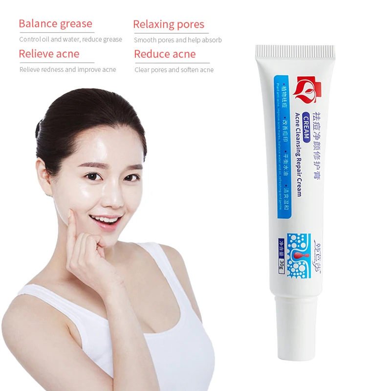 

Acne Creams Cleansing And Repairing Fades Acne Marks Oil Control Refreshing Anti-acne Treatment Cream Face Care TSLM1