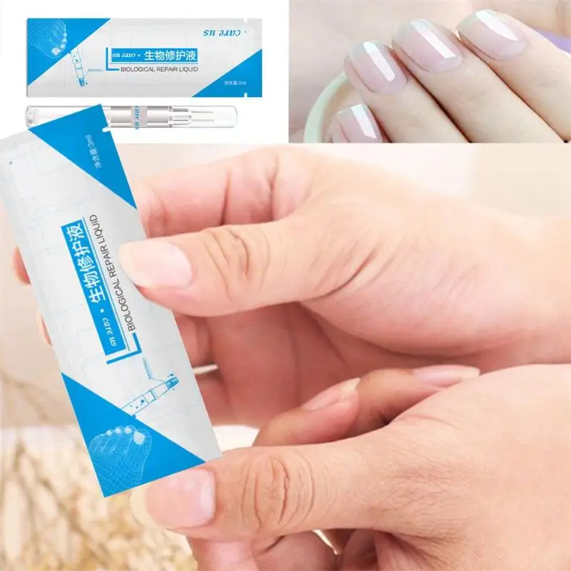 3 мл ручка для ногтей пальчиковые ногти онихомикоз пароникья инфекция флакон