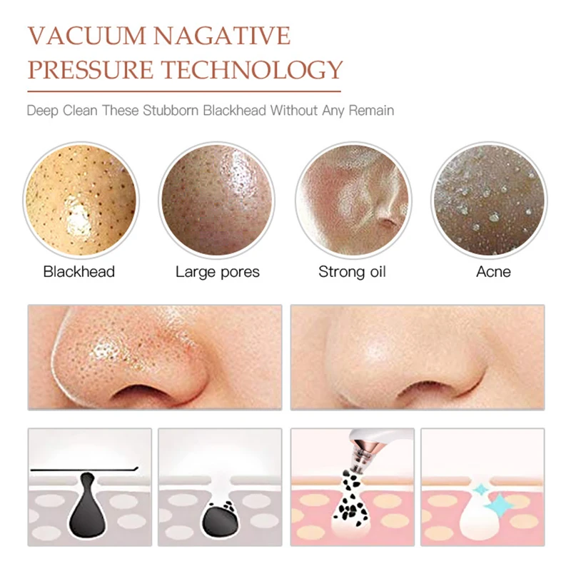 Вакуумный отсос угрей для удаления прыщей и на лице средство глубокого очищения