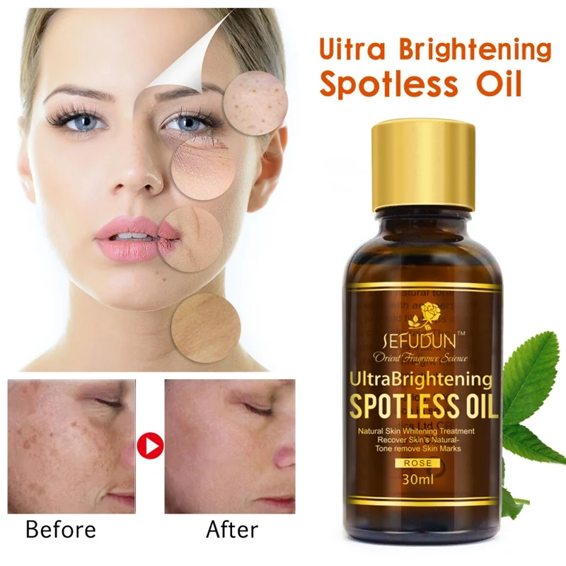 

Rose and Vitamin C Moisturizing Blemish Essential Oil Pure Spot Light Facial Skin Care Massage Oil Skin Oil Freckles Repair