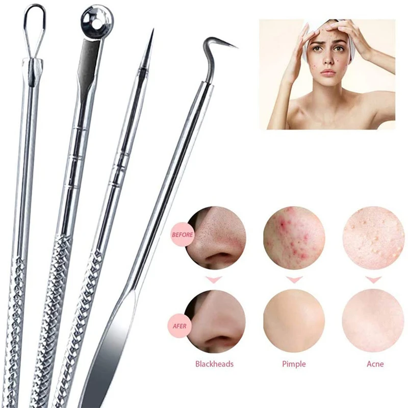 Stainless Steel Silver 4pcs Blackhead Comedone Acne Pimple Blemish Extractor Remover Tool For Face Skin Care | Красота и здоровье