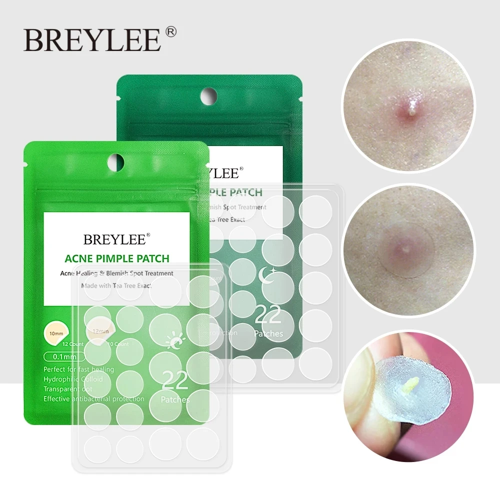 

BREYLEE Acne Pimple Patch Stickers Acne Treatment Pimple Remover Tool Blemish Spot Facial Mask Skin Care Waterproof 22 Patches