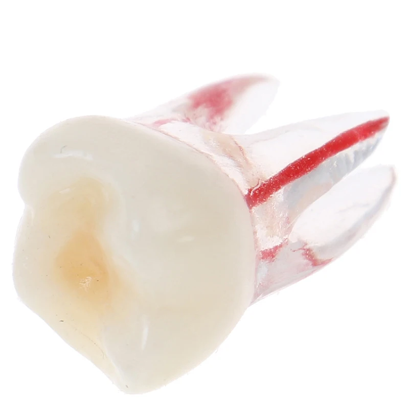 1 шт. 1:1 полимерная модель с цветным корневым каналом и целлюлозой прозрачная без