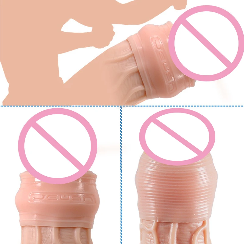 3 шт./компл. корректор Foreskin кольцо на пенис для задержки эякуляции Phimosis коррекция