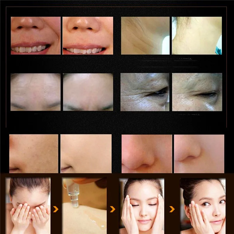 High Quality Snail 100% Pure Plant Extract Hyaluronic Acid Liquid Whitening Blemish Serum Ampoules anti-acne Rejuvenation | Красота и