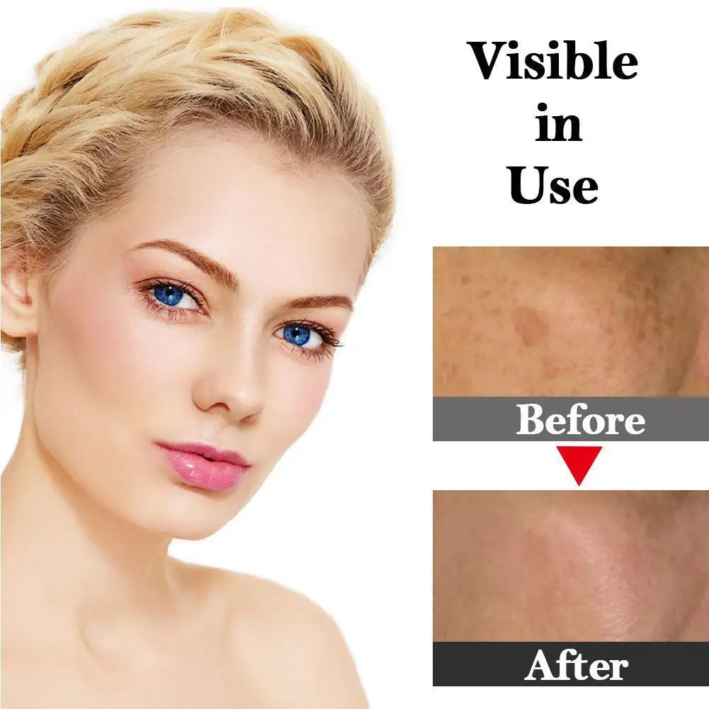 

Serum Moisturizing Lotion Whitening Face Serum Anti-age Spot Ampoule Corrective Set Skin 7*2ml Care Dark X8B1