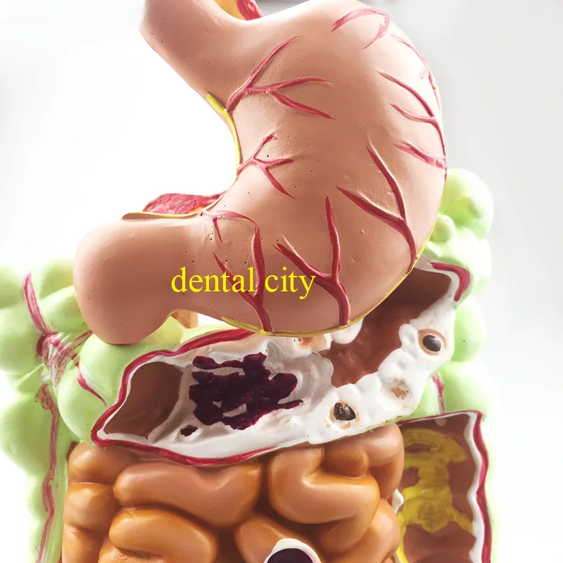 Пищеварительная система человека анатомическая модель желудка большой кишки Cecum