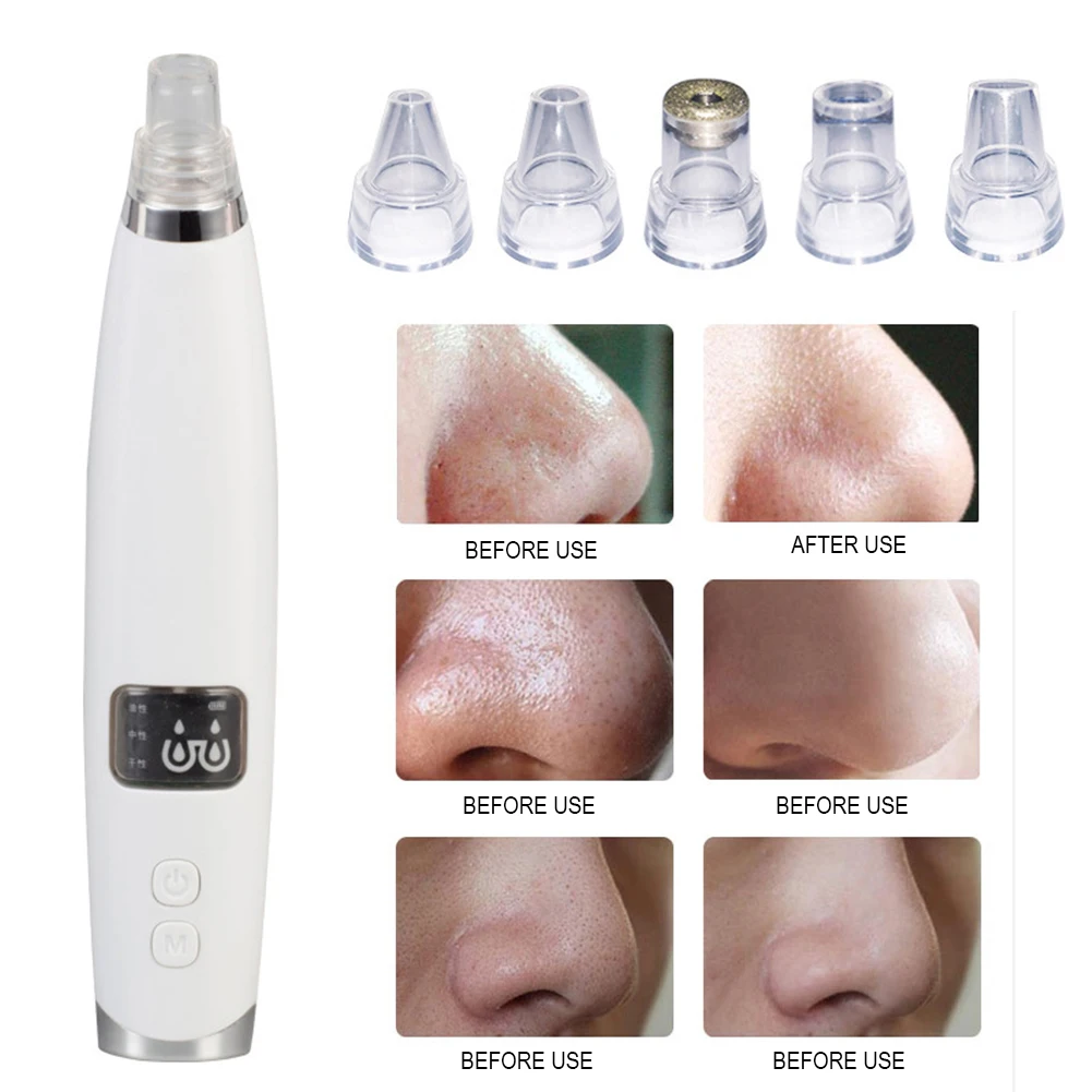 

Portable Electric Blackheads Remover Face Deep Nose Acne Cleaner Blackhead Vacuum Pore Machine Skin Care Tool