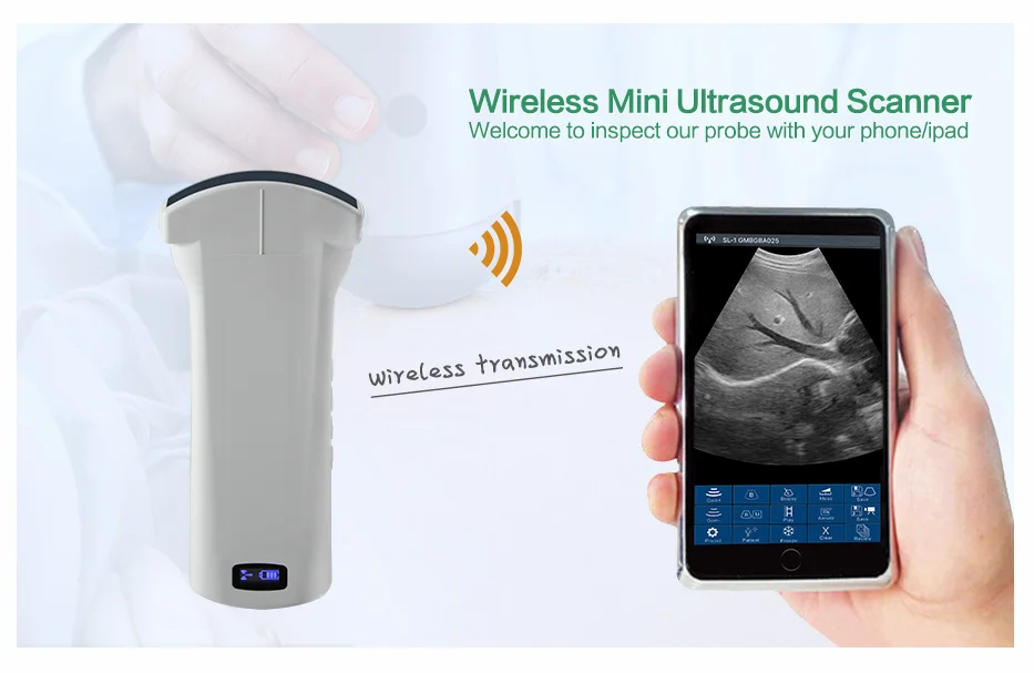 

advantage product Convex Series Probe Type Wireless Mini Ultrasound Scanner
