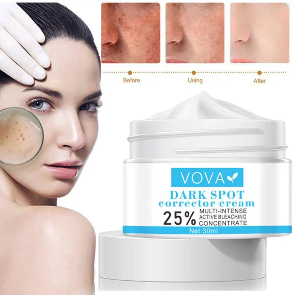 

Effective Whitening Cream Freckle Remove Melasma Acne Spots Pigmentation Pigment Dark Spot Melanin Gel Skin Care Moisturizi L8F1