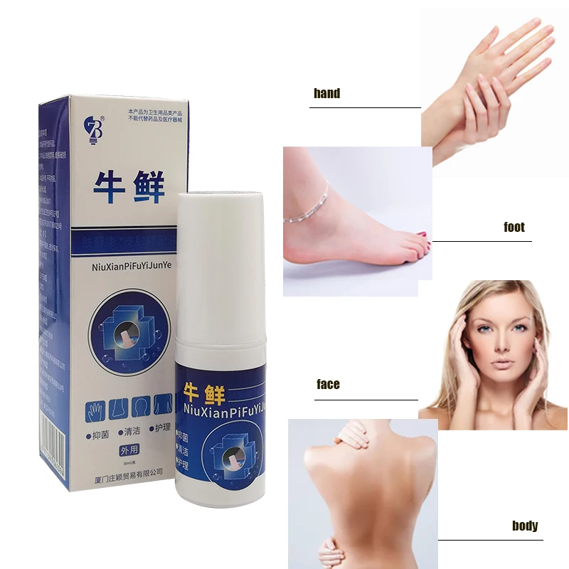 Псориаси экзма спрей Хорошо работает для проблем с кожей|cream for skin|cream psoriasiscream