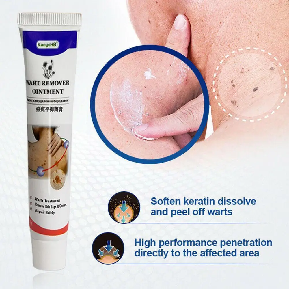 

20g Skin Tag Remover Cream Warts Remover Cream Herbal Corn Foot Remove Wart Extract Ointment Cream Treatment S1L9