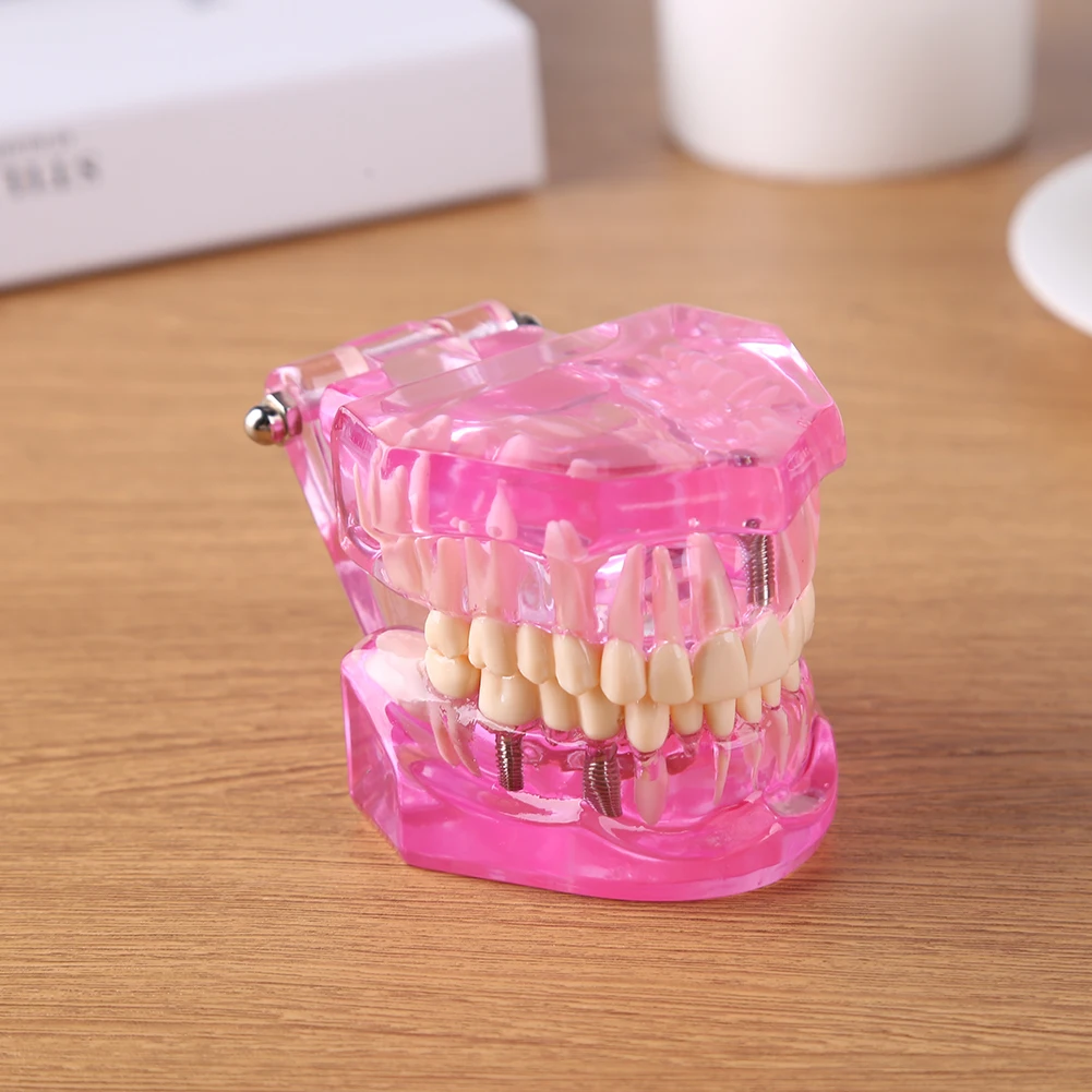 

Dental Orthodontic Model Resin Oral Teeth Model for Oral Health Medical Teaching