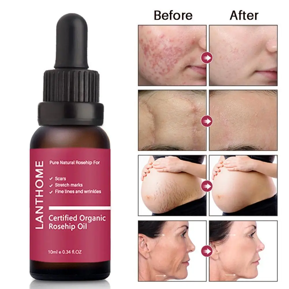 

New Firming Weight Loss Oil Skin Care Smoothing and Repair Essential Oils Slimming Body Massage Scars Stretch Bodycare Essence