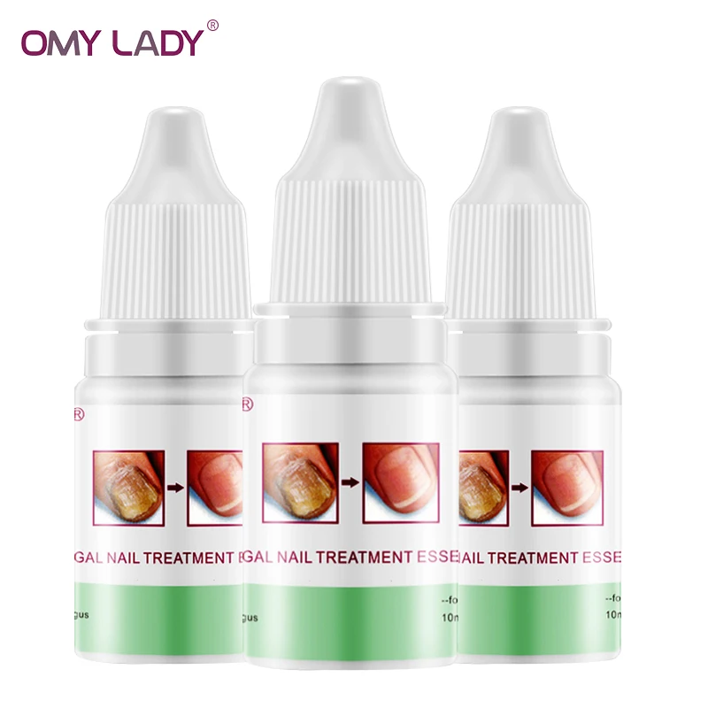 

OMY LADY 3pcs Fungal Nail Treatment Essence and Foot Whitening Toe Fungus Removal Gel Anti Infection Paronychia Onychomycosis
