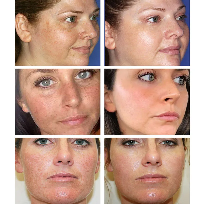 

VC Whitening Facial Cream Repair Fade Freckles Remove Dark Spots Anti Wrinkle Brightening Anti-Aging Whitening Moisturizing