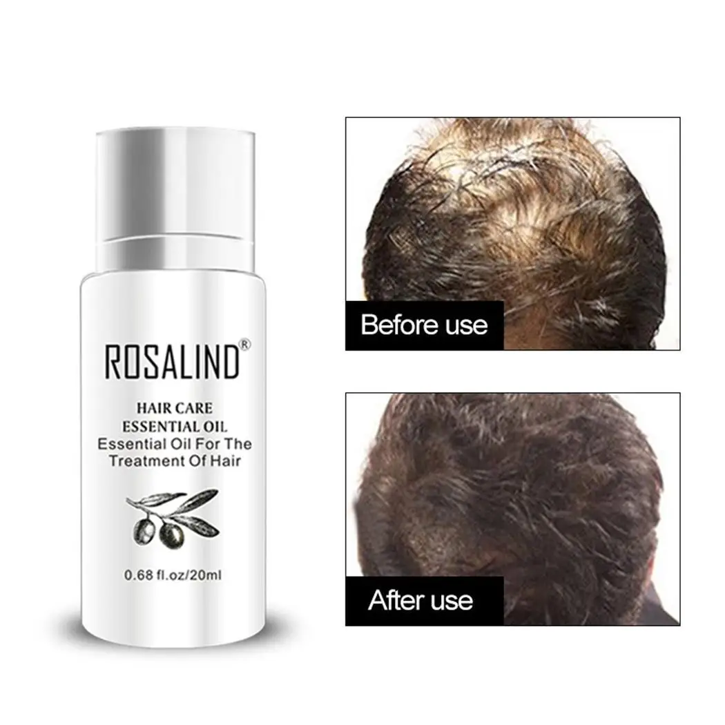 Густое эфирное масло для ухода за волосами Сыворотка лечения мужчин t