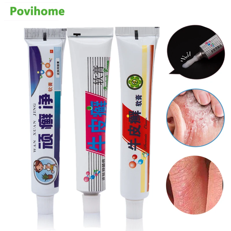

Skin Psoriasis Cream Dermatitis Eczematoid Ointment Pruritus Anti Itching Antibacterial Herbal Balm Skin Cleaning Cream