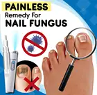 Набор для домашнего лечения грибков, сыворотка для лечения ногтей на пальцах ног, онихомикоз, паронихия, набор для ухода за грибками