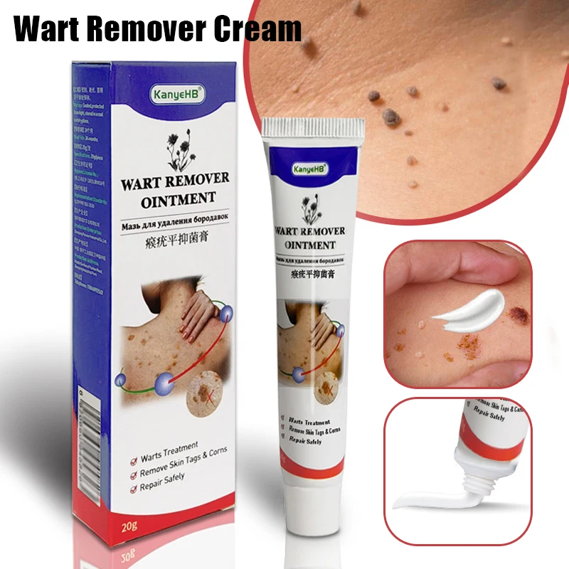 

Wart Remover Cream Easy Effective Wart Treatment Cream Remove Common Skin Tag For Women Men Wart Remover Cream Quyou Ointment