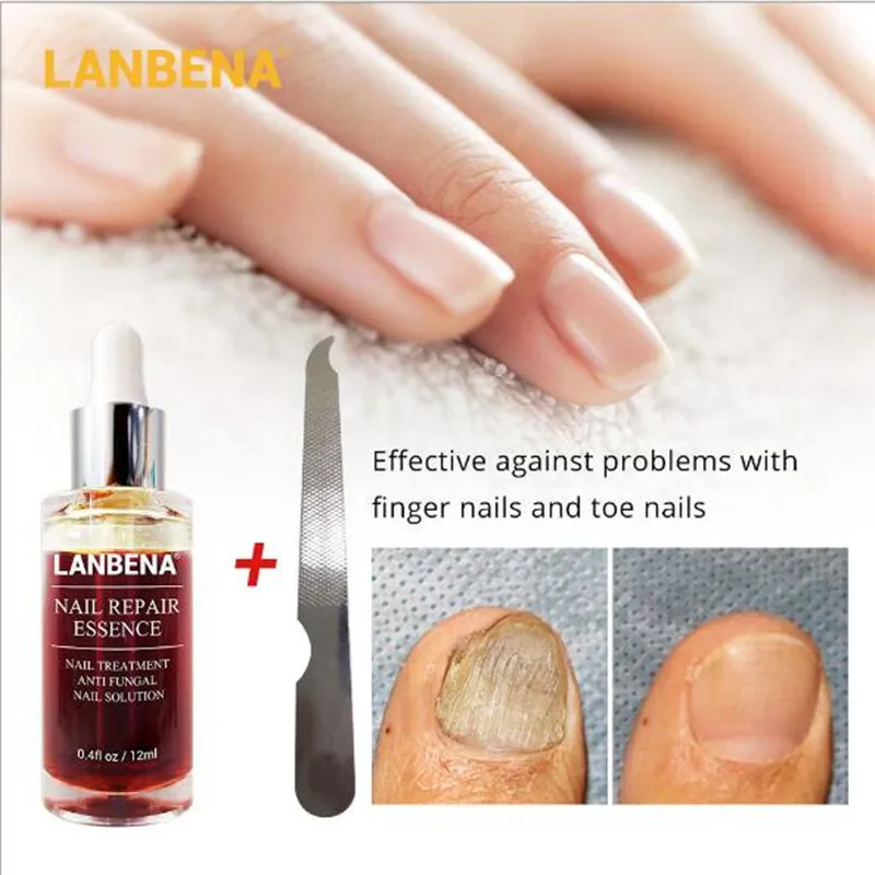 LANBENA Масло для кутикулы питательное Лечение грибка ногтей Onychomycosis Remendy Сыворотка