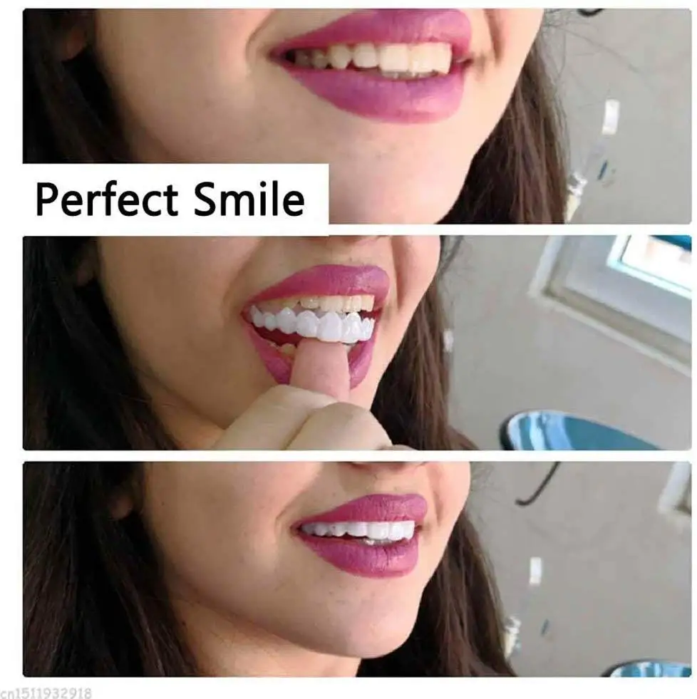Хит идеальная улыбка накладка на зубы накладные виниры белые отбеливание зубов
