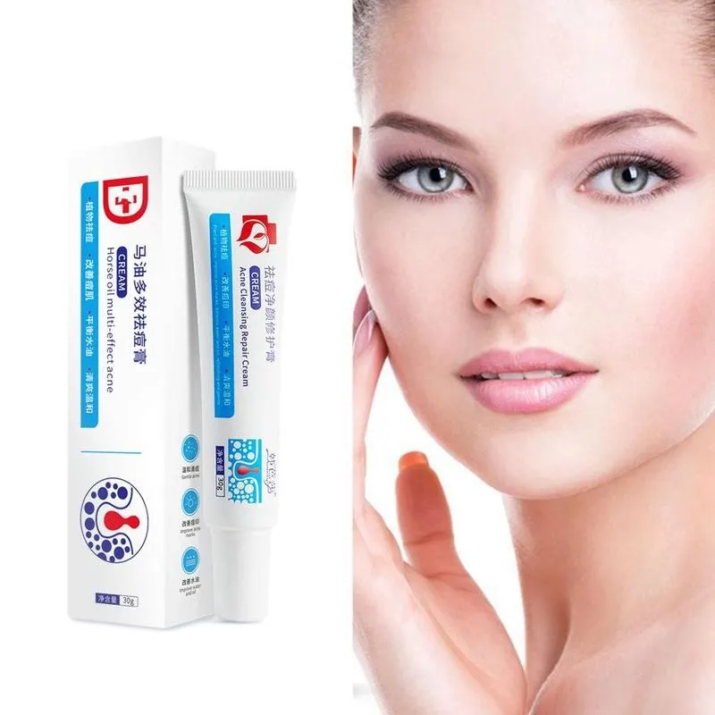 30g Acne Treatment Face Cream Blackhead Repair Gel Removal Whitening Acne Care Skin Pores Scar Cream Shrink W5G2