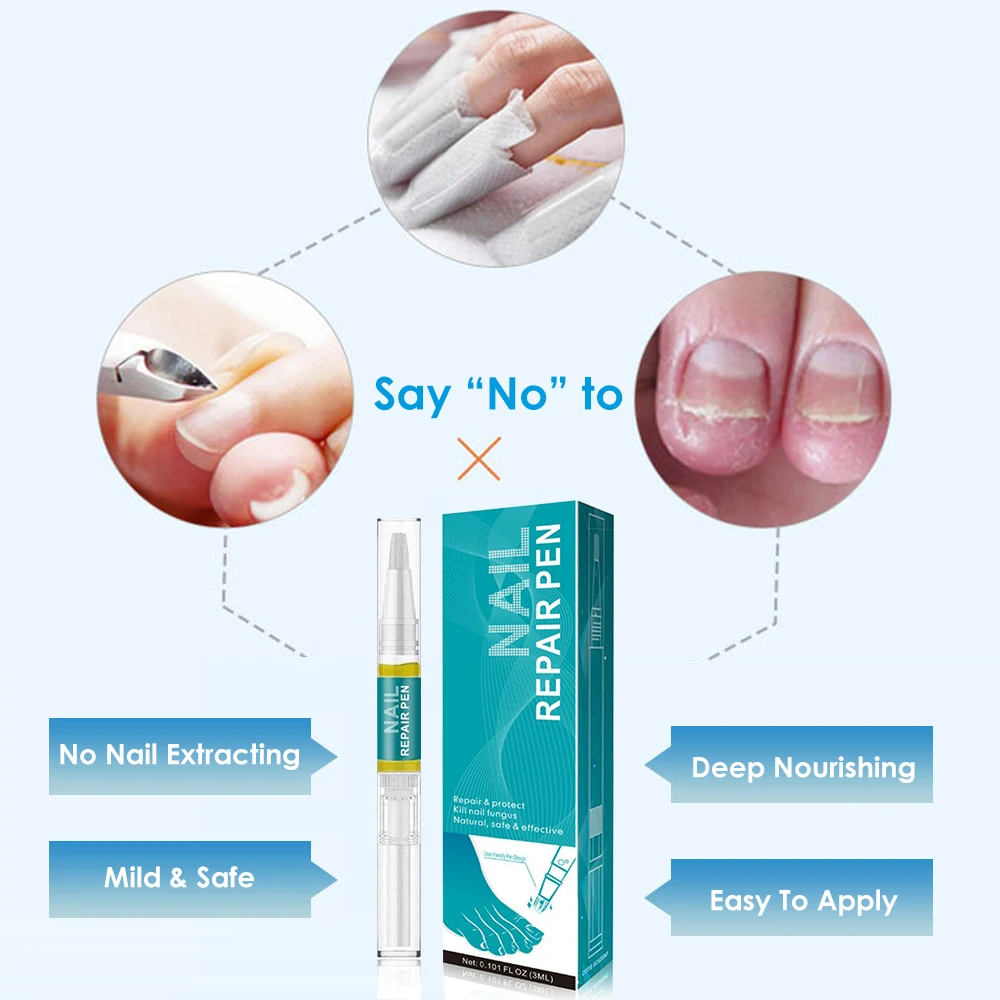 2 шт. 3 мл ручка для лечения Ногтей онихомикоз паронихия противогрибковая