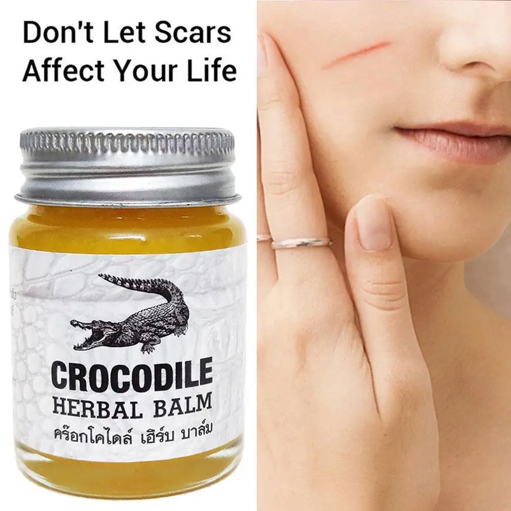 

Thailand Herbal Balm Crocodile Scar Removal Cream Whitening Scar Acne Remover Marks Face Stretch Cream Corrector Pigmentati L1I7