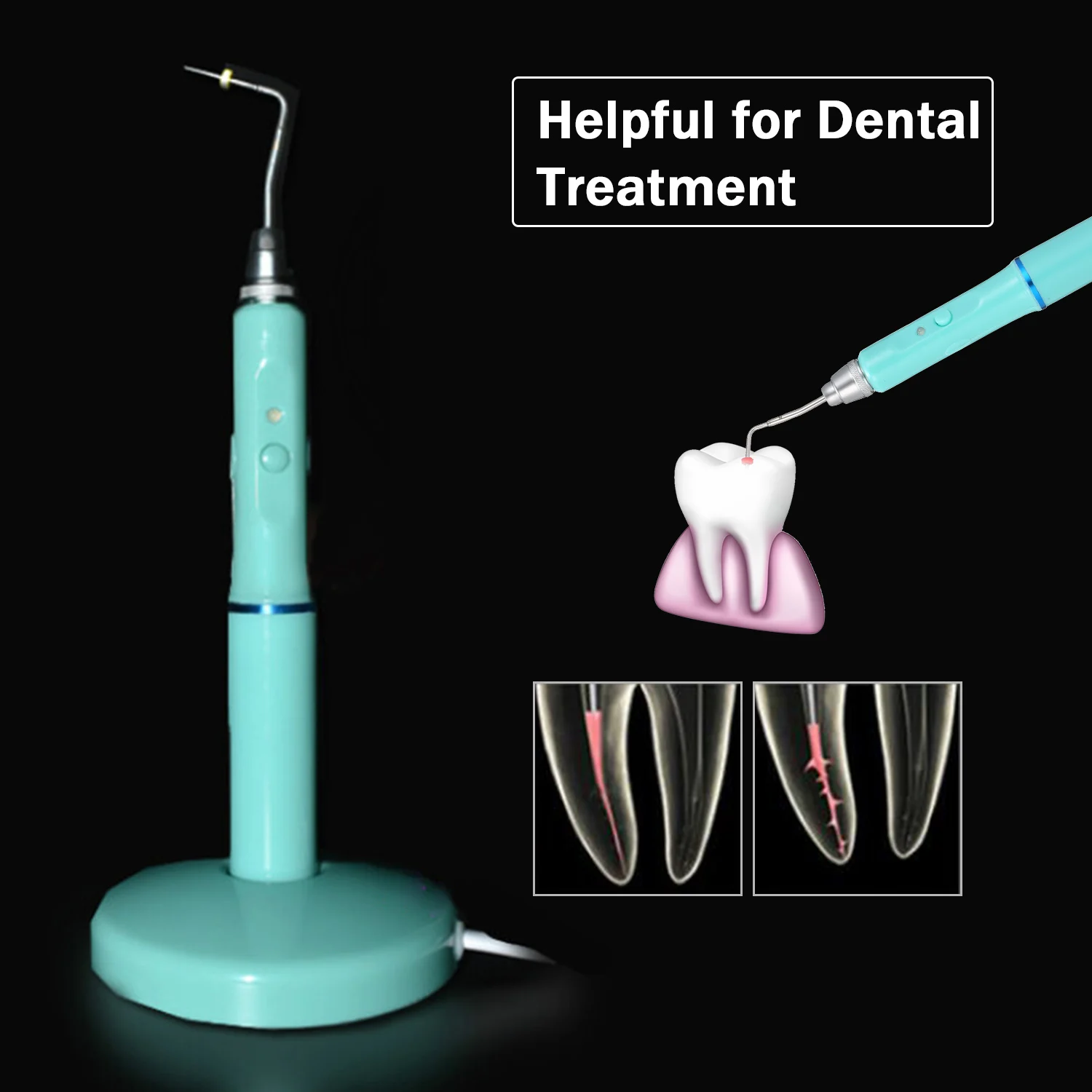 Электрическая ручка для обтурации беспроводная система Гутта перча