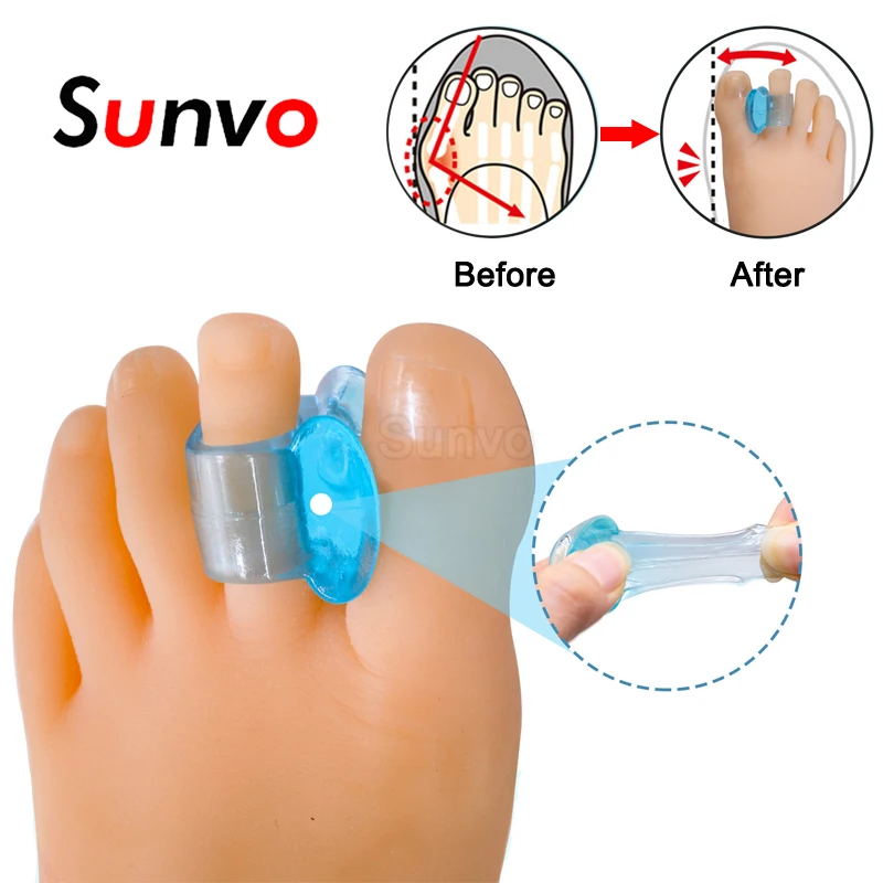 Sunvo Silicone Foot Toe Separator Hallux Valgus Corrector Orthopedic Supplies Bunion Thumb Straightener Adjuster Feet Care Tools