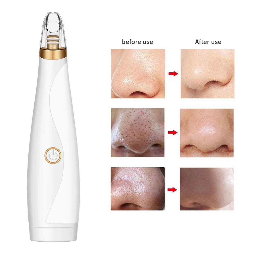 акне очиститель пор вакуумный вакуум для лица от черных точек инструменты
