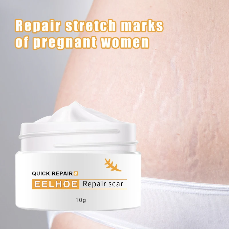 

10g-50g Acne Scar Removal Cream Pimples Stretch Marks Face Gel Remove Acne Smoothing Whitening Moisturizing Body Skin Care cream
