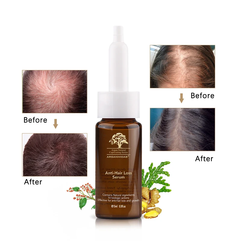 15ml Anti-hair Loss Ginger Oil Hair Growth Product Natural extraction material For Man and Woman Free Shipping | Красота и здоровье