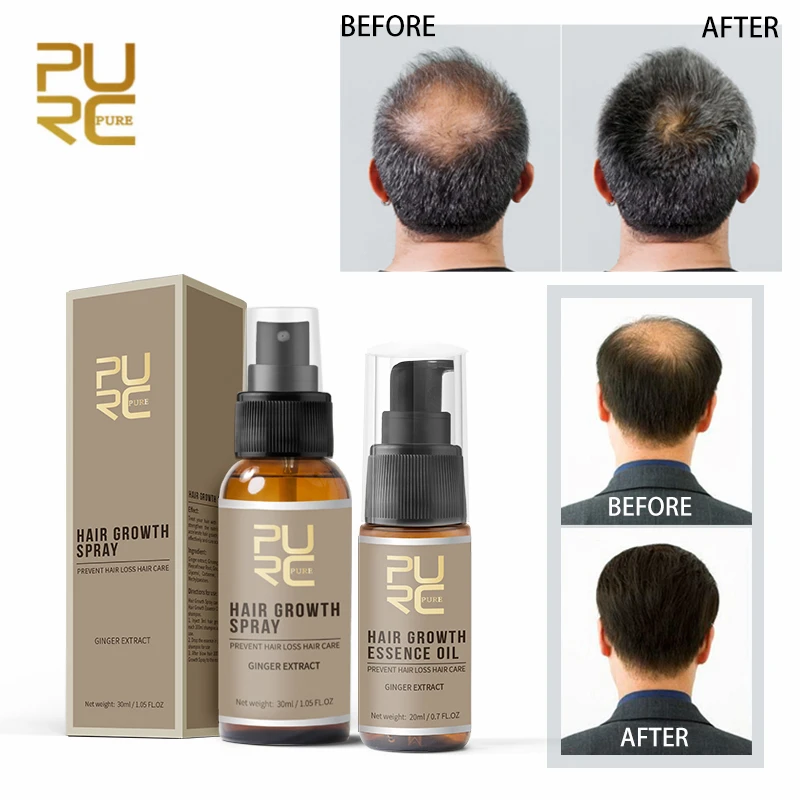 

PURC 2PCS 30ml Hair Care Treatment Hair Growth Spray Ginger Extract Prevent Hair Loss Help Hair Growth Essential Oil Hair Care