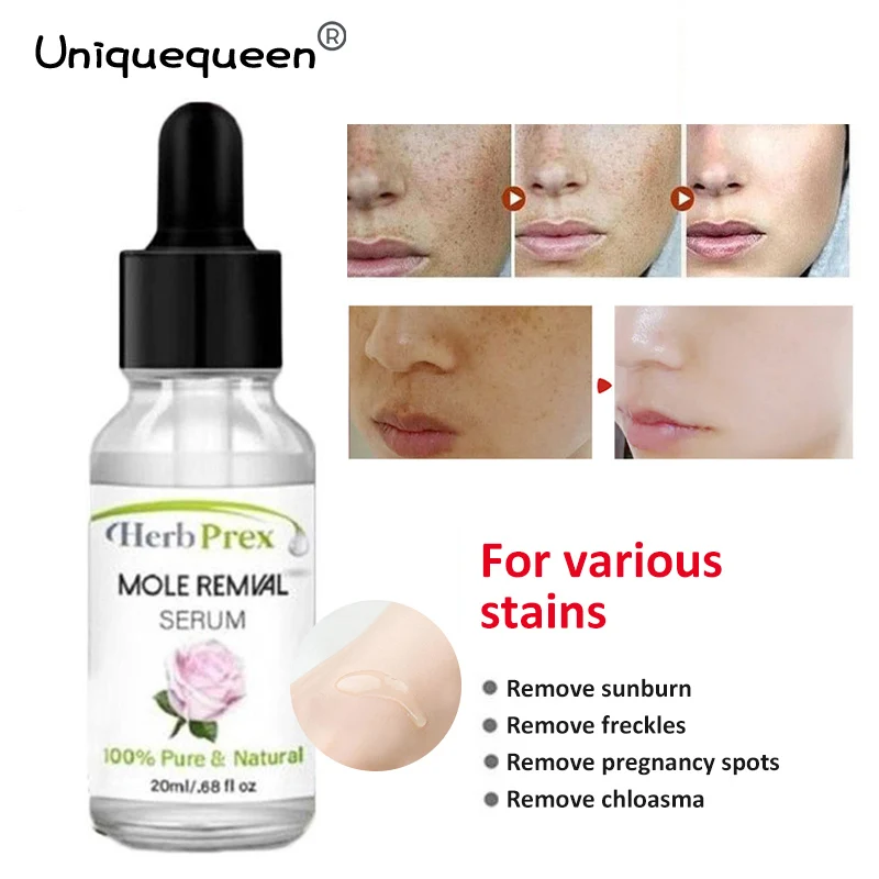 

VENZEN No Trace Mole Removal Cream Essential Oil Organic Tags Solutions Serum Skin Tag Mole Freckle Spot Fast Remover Skincare
