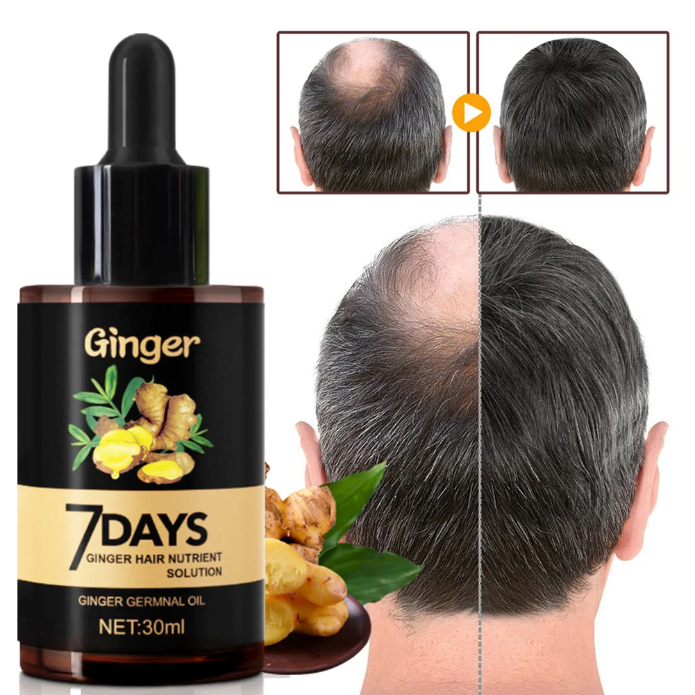 

7 Days Fast Hair Growth Essence Oil Ginger Hair Growth Serum Nourishing Soften Treatment Hair Loss Repair Damaged Hair 30ml