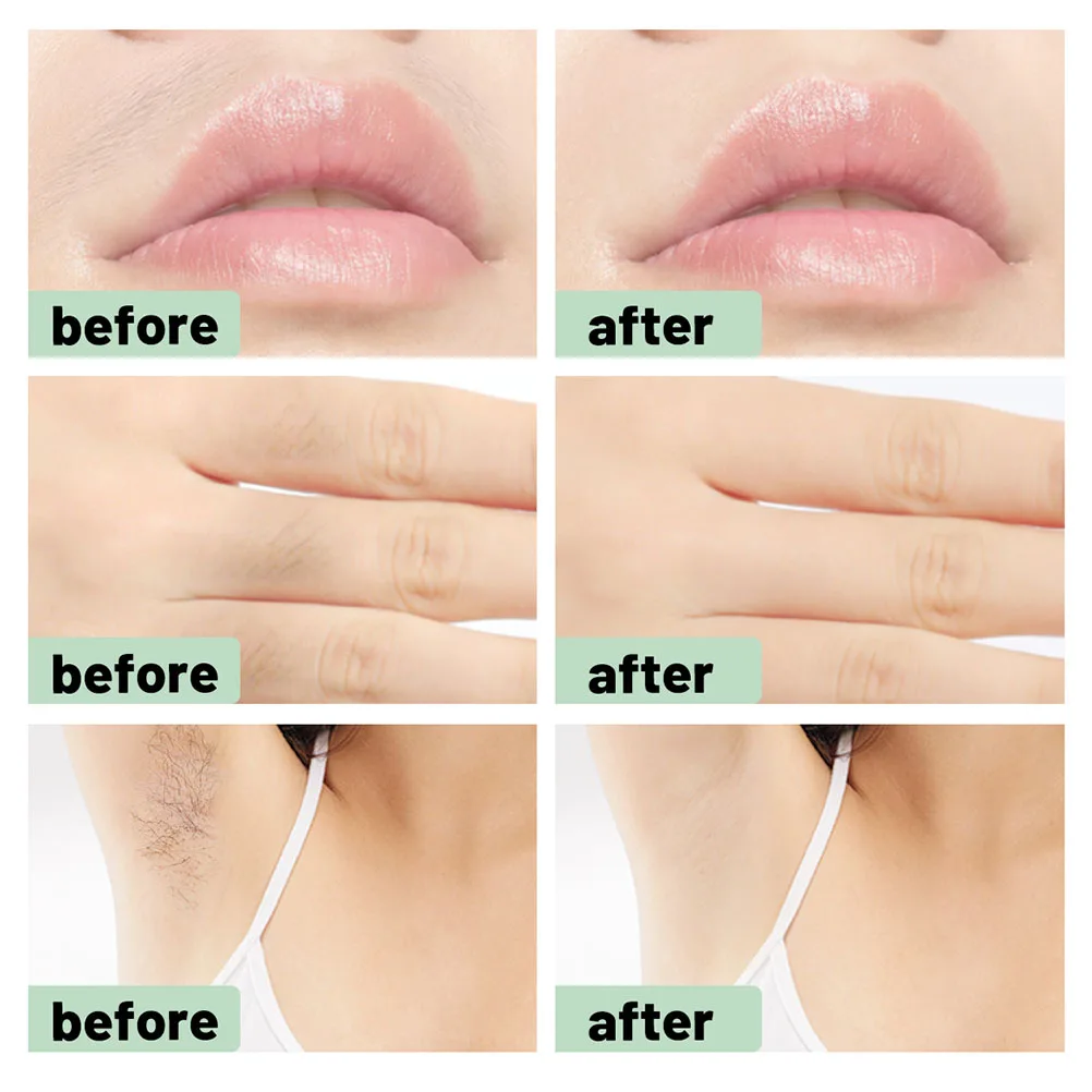 

1 Set Lip Hair Remover Wax Strip Home Waxing Kit Disposable Wax Stripes