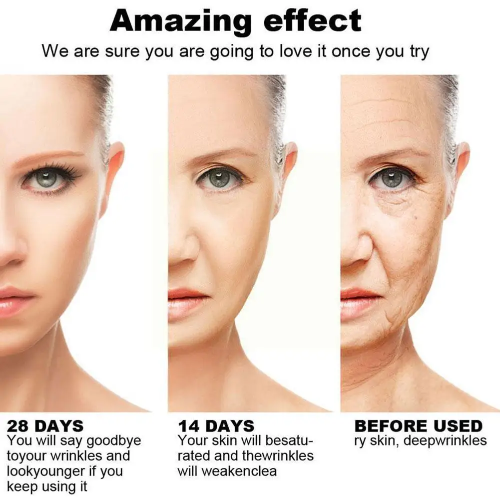 

1pc 30ml Mad Vitamin C Essence Serum Anti-aging Pore Care Cream Essence Skin Shrinking Moisturizing Face Whitening L0W7