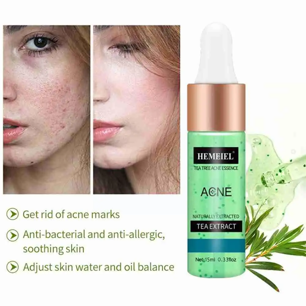 

15g Tea Tree Acne Treatment Serum Effectively Fade Spots Face Pore Essence Skin Care Whitening Shrinks Repair Moisturizing E7J1