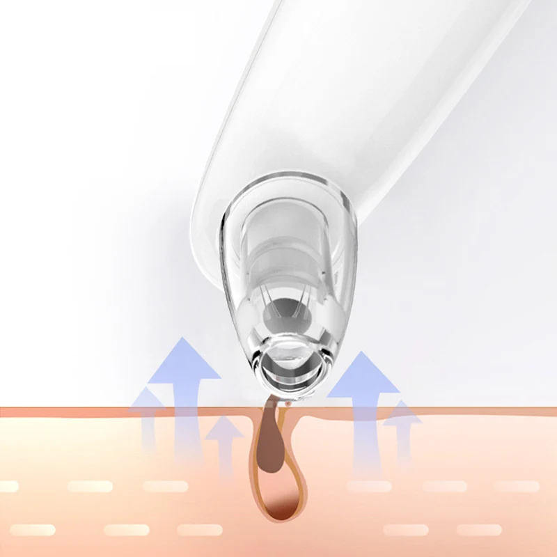 

Acne Removal Electric USB Vacuum Suction Skin Care Machine Dropshipping