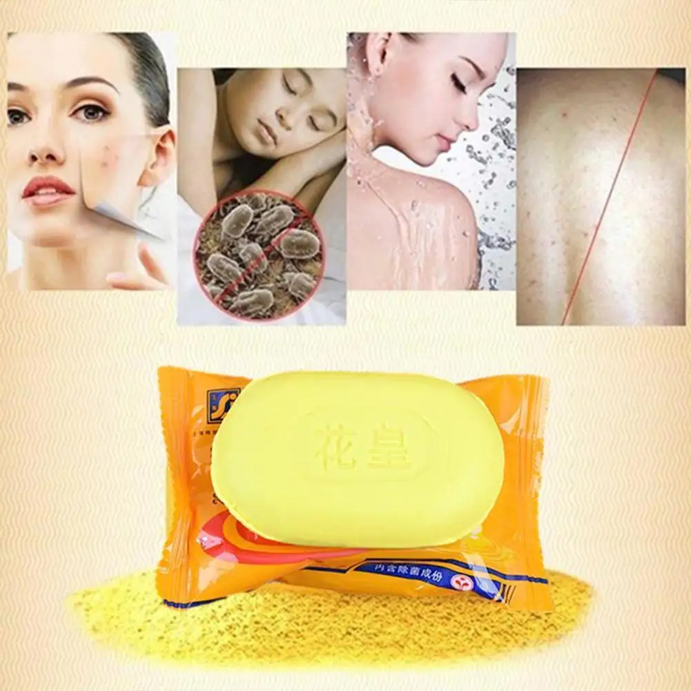 

New 85g Sulphur Soap Skin Care Dermatitis Fungus Eczema Anti Skin Bacteria Cleaning Whitening Bath Fungus Soaps Care Shower K1V1